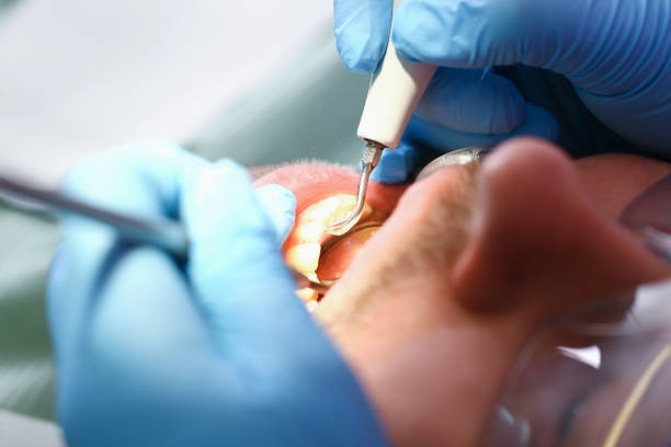 Best Emergency Dental Care for Abscessed Tooth in Briar, TX
